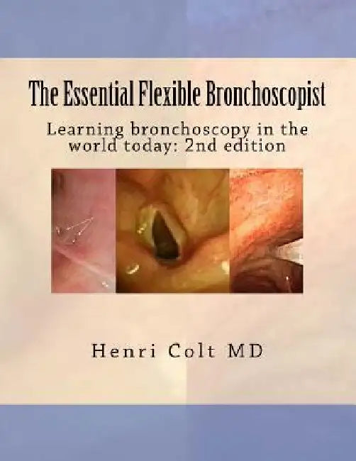 The Essential Flexible Bronchoscopist: Learning bronchoscopy in the world today by Henri Colt