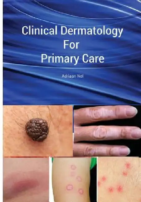 Clinical Dermatology For Primary Care by Adriaan Nel