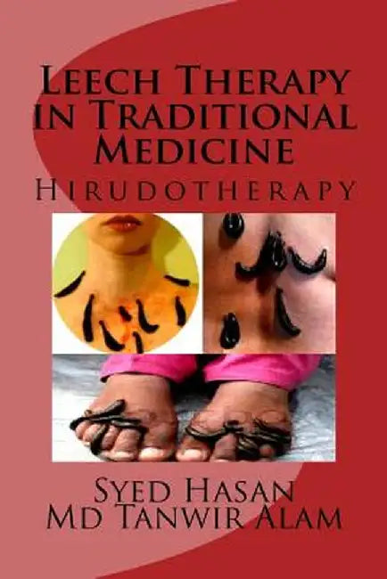 Leech Therapy In Traditional M