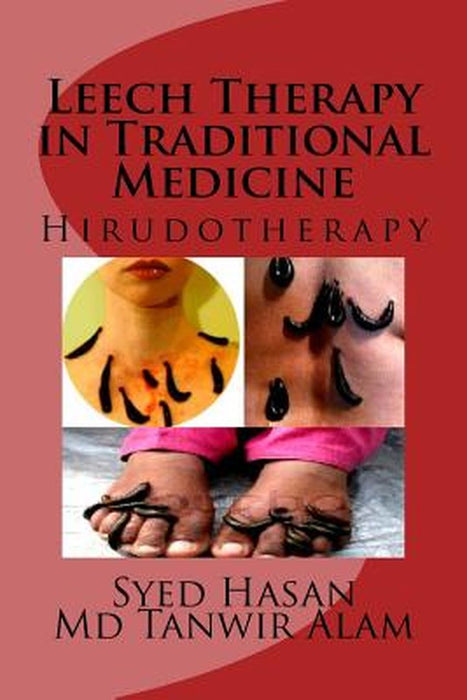 Leech Therapy In Traditional M by 
