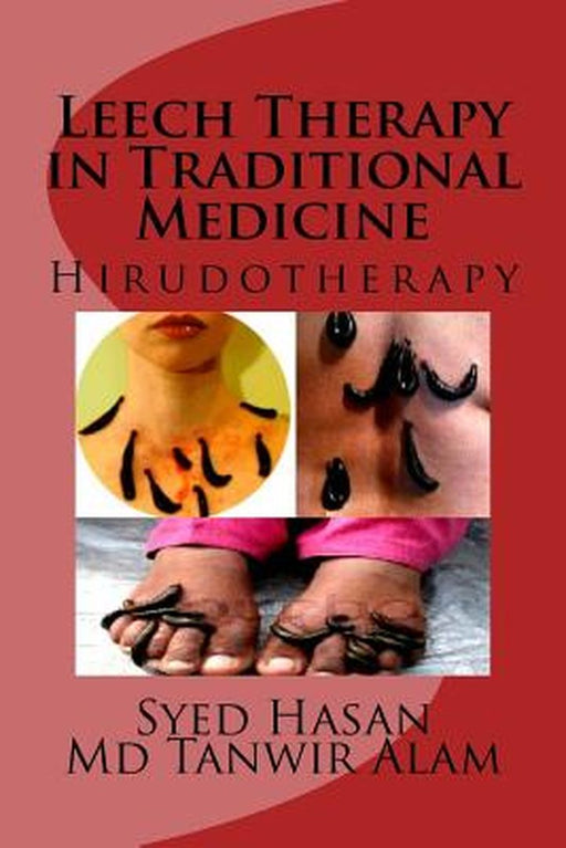 Leech Therapy In Traditional M by 