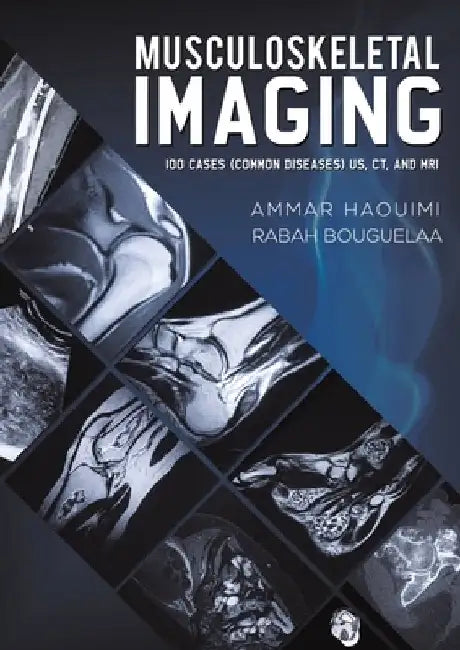 Musculoskeletal Imaging by Ammar Haouimi