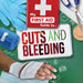 Cuts and Bleeding by Joanna Brundle