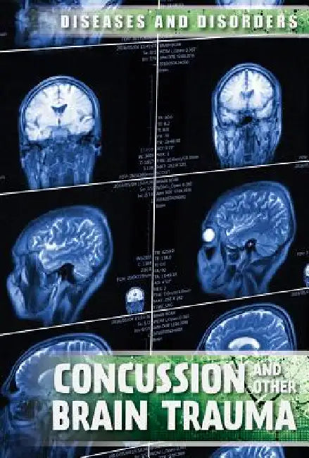 Concussions and Other Brain Trauma by Ryan Nagelhout
