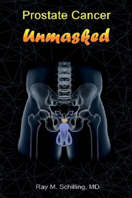 Prostate Cancer Unmasked by Ray M. Schilling