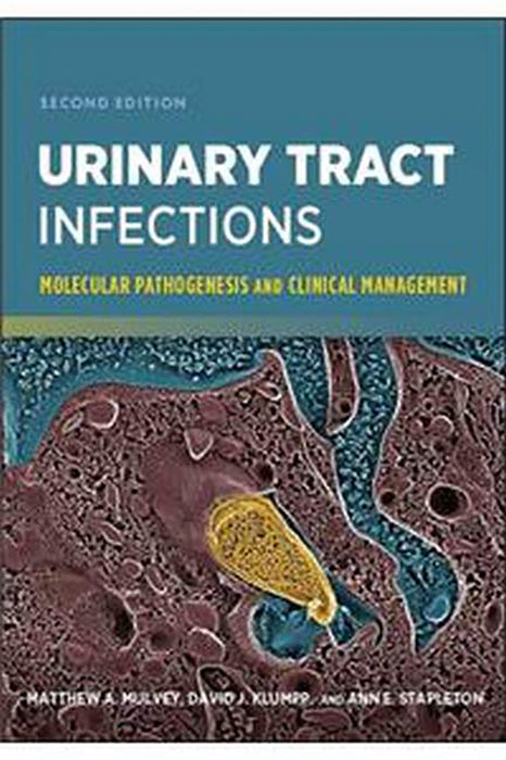 Urinary Tract Infections: Molecular Pathogenesis and Clinical Management