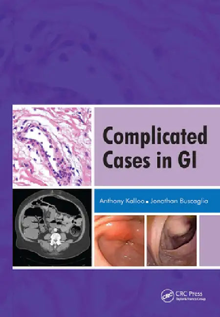 Complicated Cases in GI by Anthony Kalloo