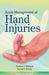 Acute Management of Hand Injuries by Andrew Weiland, Rachel Rohde