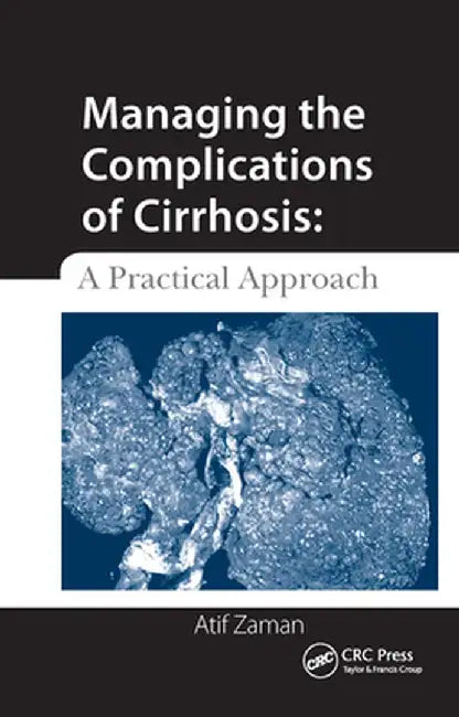 Managing the Complications of Cirrhosis: A Practical Approach by Atif Zaman