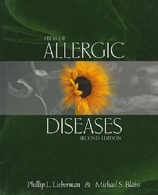 Atlas of Allergic Diseases by J. McCullough, Phillip L. Lieberman, W. Langenfeld