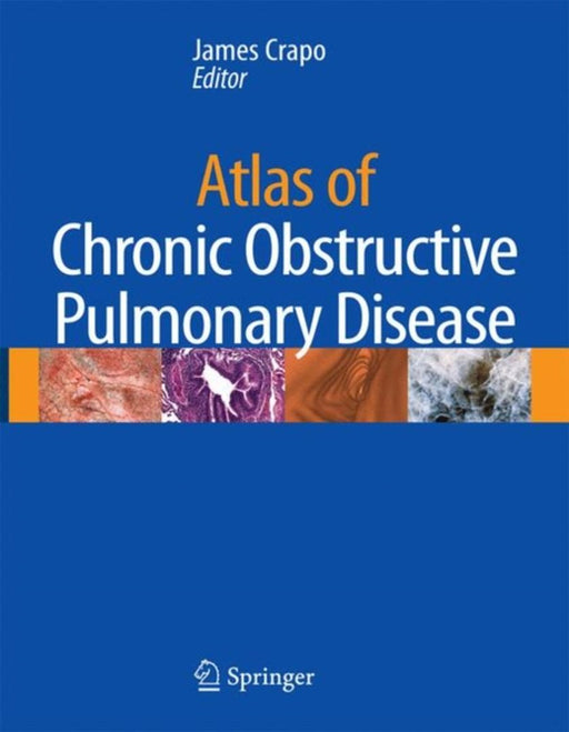 Atlas Of Chronic Obstructive Pulmonary Disease by James D. Crapo