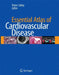 Essential Atlas of Cardiovascular Disease [With CDROM] by Peter Libby