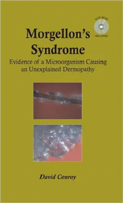 Morgellon's Syndrome by David Conroy