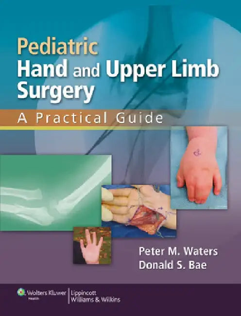 Pediatric Hand and Upper Limb Surgery: A Practical Guide by Peter M. Waters