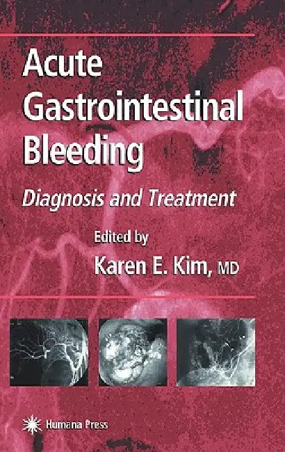 Acute Gastrointestinal Bleeding: Diagnosis and Treatment by Karen E. Kim