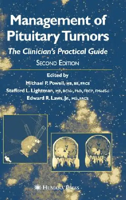 Management of Pituitary Tumors: The Clinician's Practical Guide by Michael P. Powell, Stafford L. Lightman, Edward R. Laws Jr