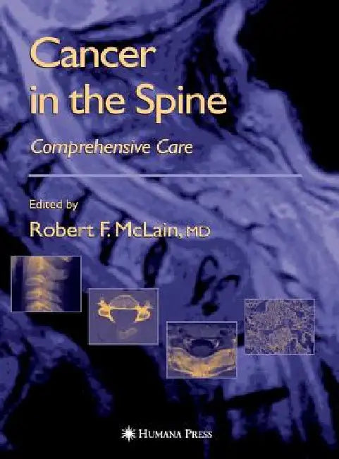 Cancer in the Spine: Comprehensive Care by Robert F. McLain, Maurie Markman, Ronald M. Bukowski