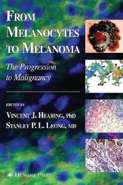From Melanocytes to Melanoma: The Progression to Malignancy by Vincent J. Hearing