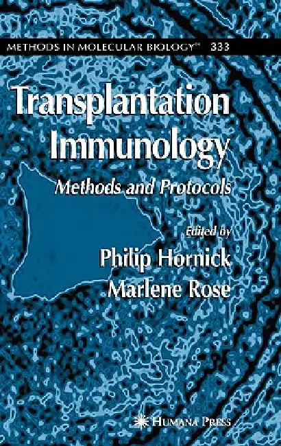Transplantation Immunology: Methods and Protocols by Philip Hornick