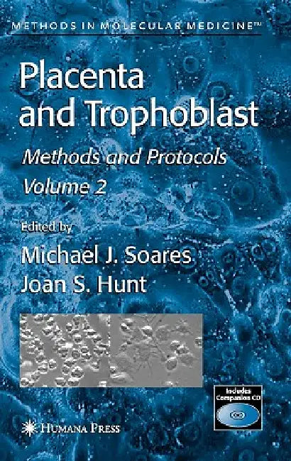 Placenta and Trophoblast: Methods and Protocols, Volume II by Michael J. Soares, Joan S. Hunt