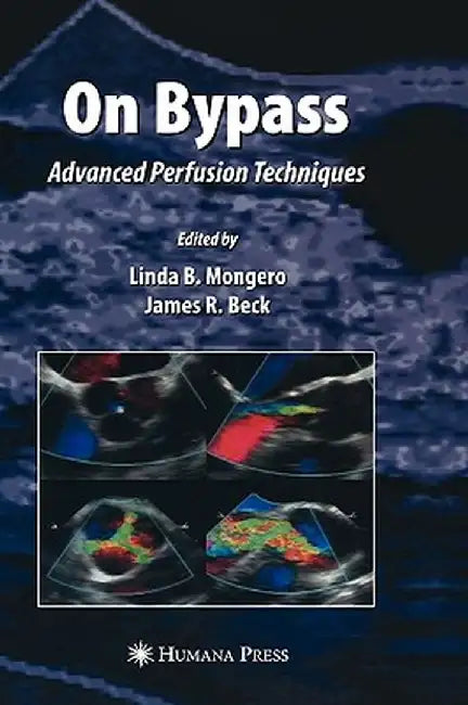 On Bypass: Advanced Perfusion Techniques by Linda B. Mongero