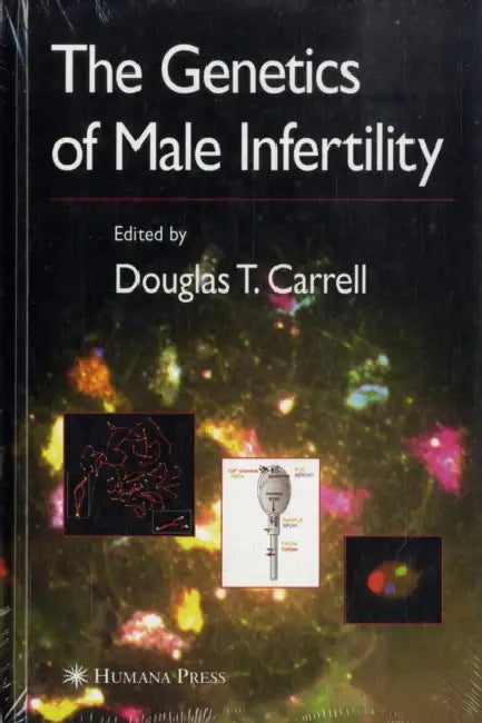 The Genetics of Male Infertility by Douglas T. Carrell