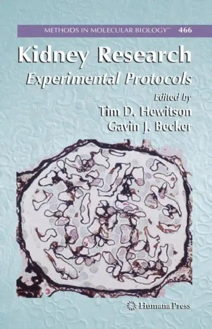 Kidney Research: Experimental Protocols by Tim D. Hewitson, Gavin J. Becker