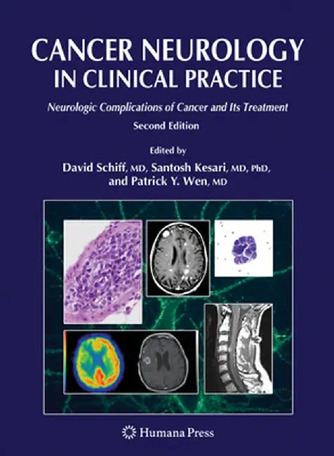 Cancer Neurology in Clinical Practice: Neurologic Complications of Cancer and Its Treatment by David Schiff