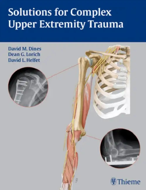 Solutions For Complex Upper Extremity Trauma-(Exab) by David M. Dines