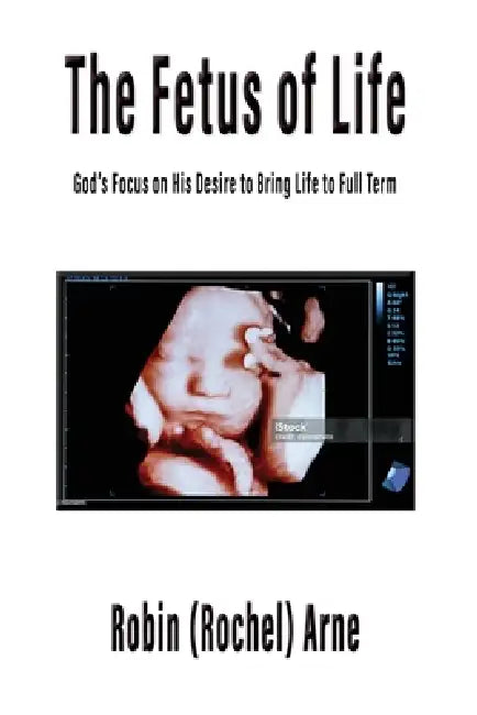 The Fetus of Life: God's Focus on His Desire to Bring Life to Full Term by Robin Arne