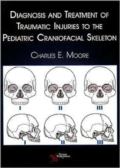 Diagnosis and Treatment of Traumatic Injuries to the Pediatric Craniofacial Skeleton by Charles E. Moore
