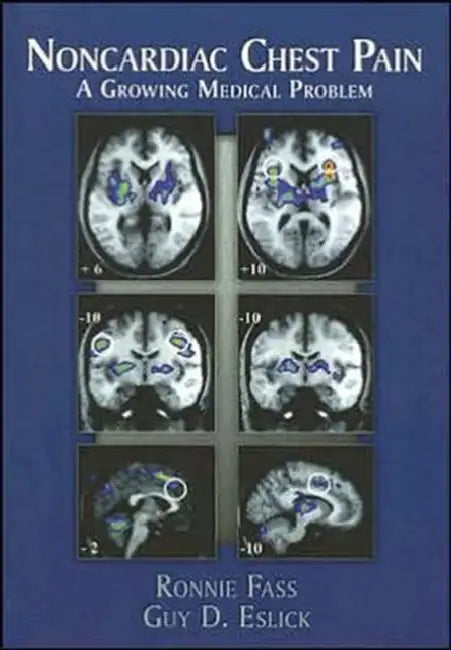 Noncardiac Chest Pain: A Growing Medical Problem by Ronnie Fass, Guy D. Eslick