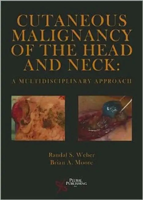 Cutaneous Malignancy of the Head and Neck: A Multidisciplinary Approach by Randal S. Weber, Brian A. Moore