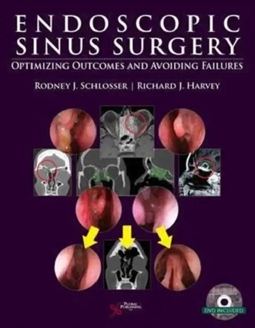 Endoscopic Sinus Surgery: Optimizing Outcomes and Avoiding Failures by Rodney Schlosser