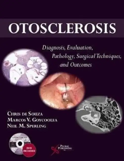 Otosclerosis: Diagnosis, Evaluation, Pathology, Surgical Techniques, and Outcomes by Chris De Souza, Marcos V. Goycoolea, Neil M. Sperling