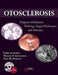 Otosclerosis: Diagnosis, Evaluation, Pathology, Surgical Techniques, and Outcomes by Chris De Souza, Marcos V. Goycoolea, Neil M. Sperling