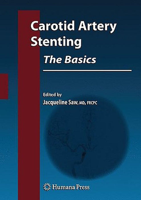 Carotid Artery Stenting: The Basics - How to Set Up and Maintain a Cath Lab by Jacqueline Saw