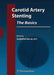 Carotid Artery Stenting: The Basics - How to Set Up and Maintain a Cath Lab by Jacqueline Saw