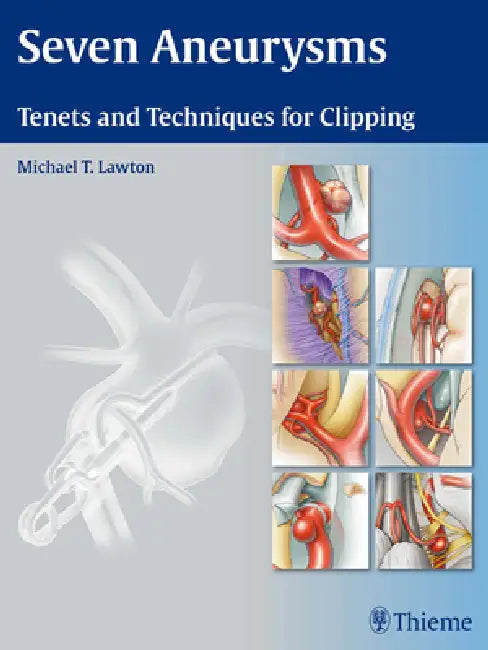 Seven Aneurysms: Tenets and Techniques for Clipping by Michael T. Lawton