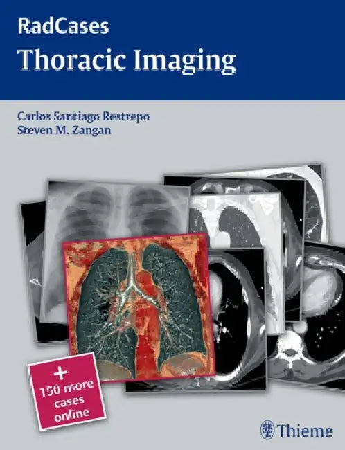 Thoracic Imaging [With Access Code] by Carlos S. Restrepo