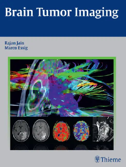 Brain Tumor Imaging by Rajan Jain, Marco Essig