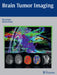 Brain Tumor Imaging by Rajan Jain, Marco Essig