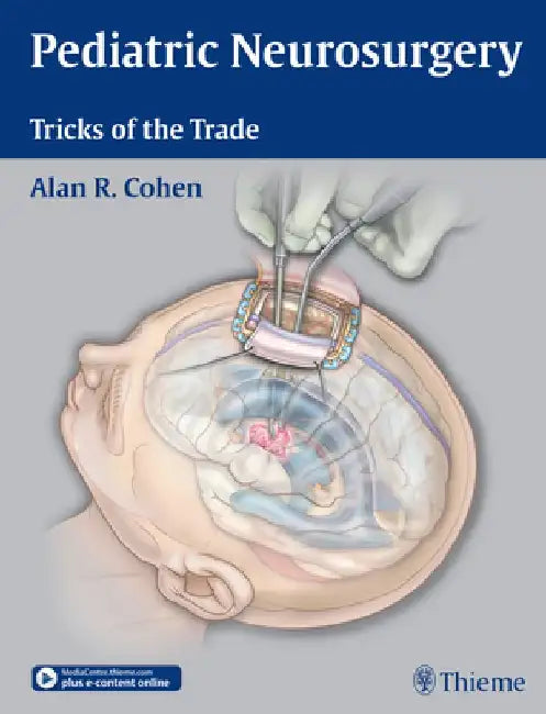Pediatric Neurosurgery: Tricks of the Trade by Alan R. Cohen