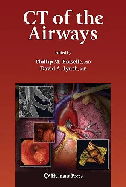 CT of the Airways by Phillip M. Boiselle, David Lynch