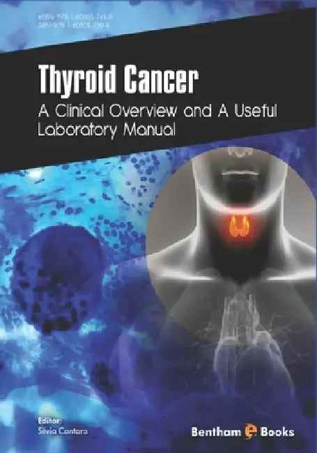 Thyroid Cancer: A Clinical Overview and a Useful Laboratory Manual by Silvia Cantara