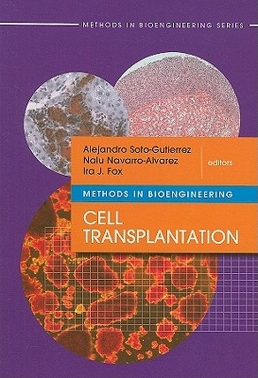 Cell Transplantation by Alejandro Soto-Gutierrez, Nalu Navarro-Alvarez, Ira J. Fox