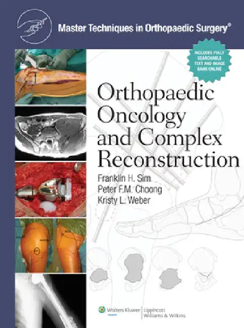 Master Techniques in Orthopaedic Surgery: Orthopaedic Oncology and Complex Reconstruction by Franklin H. Sim