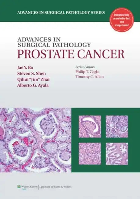 Prostate Cancer by Jae Y. Ro