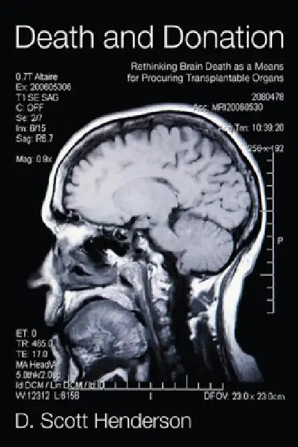 Death and Donation: Rethinking Brain Death as a Means for Procuring Transplantable Organs by D. Scott Henderson