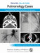 Pediatric Collections: Pulmonology Cases: Case Reports from Pediatrics in Review by American Academy of Pediatrics (Aap)